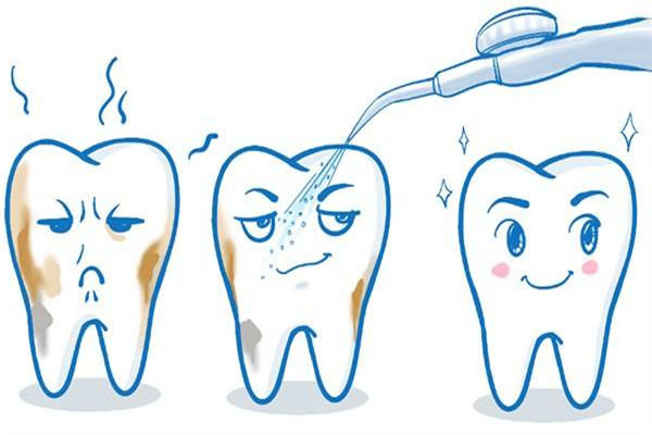 为什么洗牙有异物感 洗牙的误区