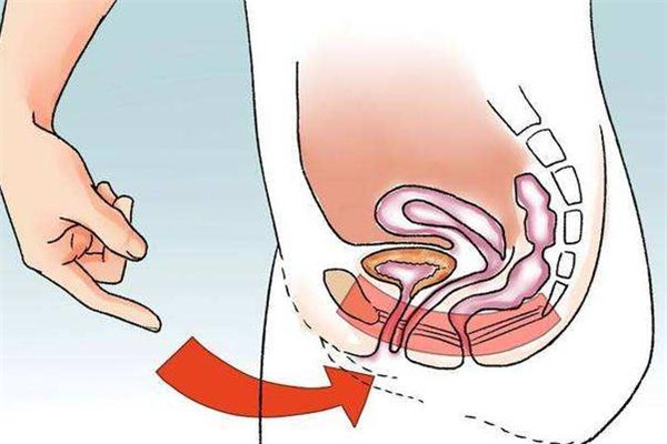 产后盆底肌修复最佳时间 产后盆底肌怎么修复